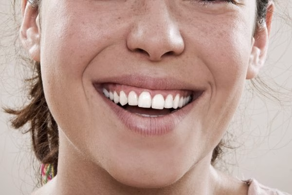 Armonización orofacial