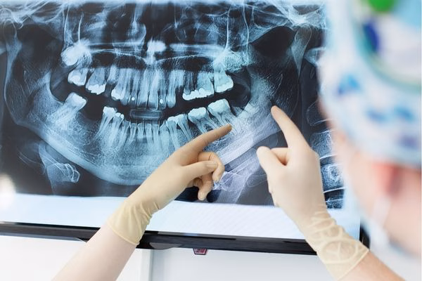 radiografías dentales
